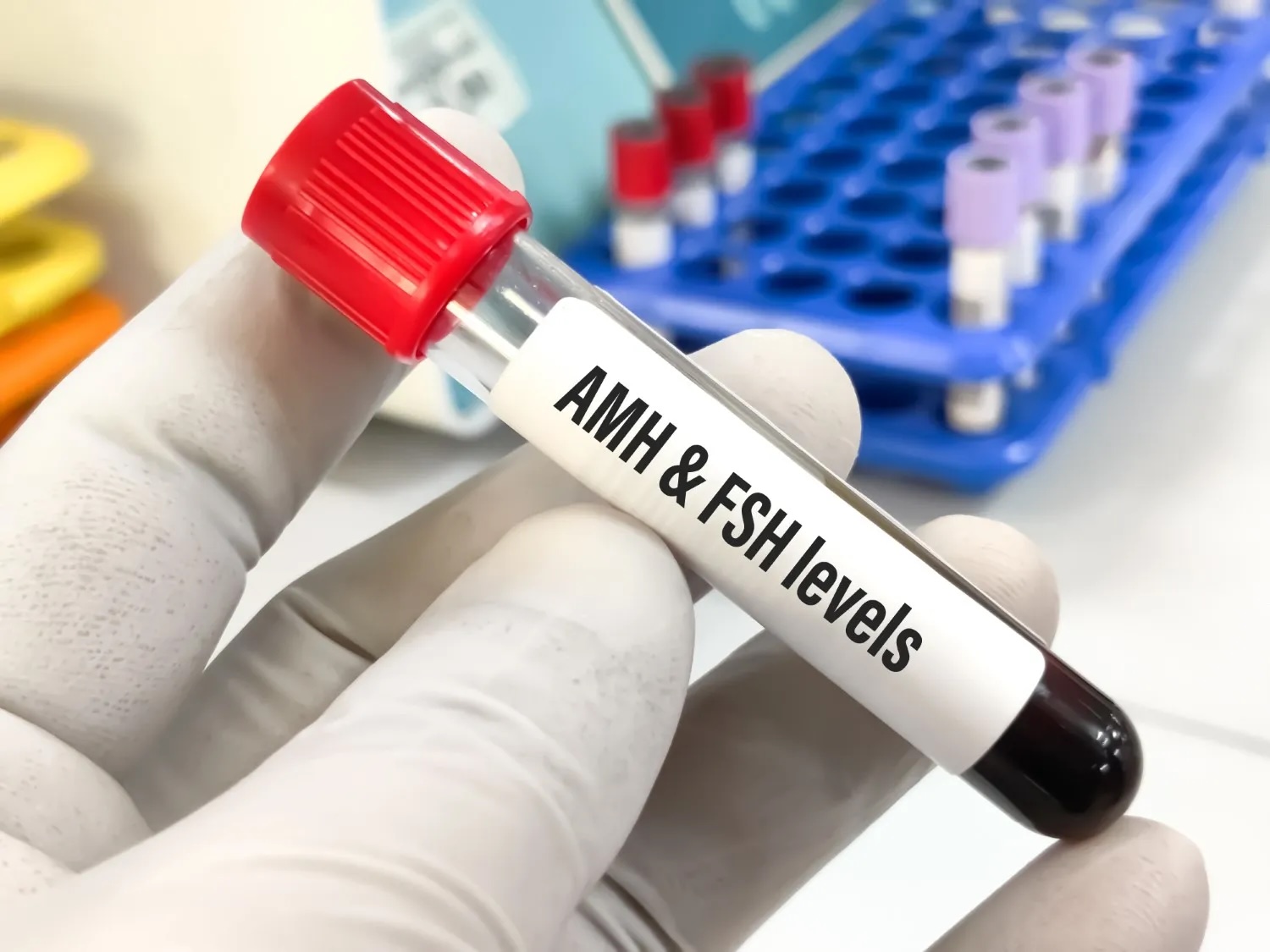 Gloved hand holding a blood sample for AMH and FSH testing, two important fertility tests used to assess ovarian reserve during IVF treatment. 