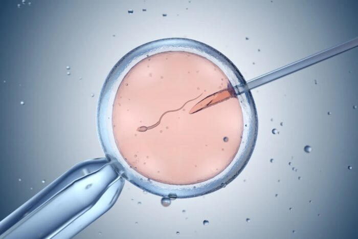 Microscopic view of an intracytoplasmic sperm injection (ICSI) procedure during IVF treatment, showing sperm being injected directly into an egg to support fertilisation.
